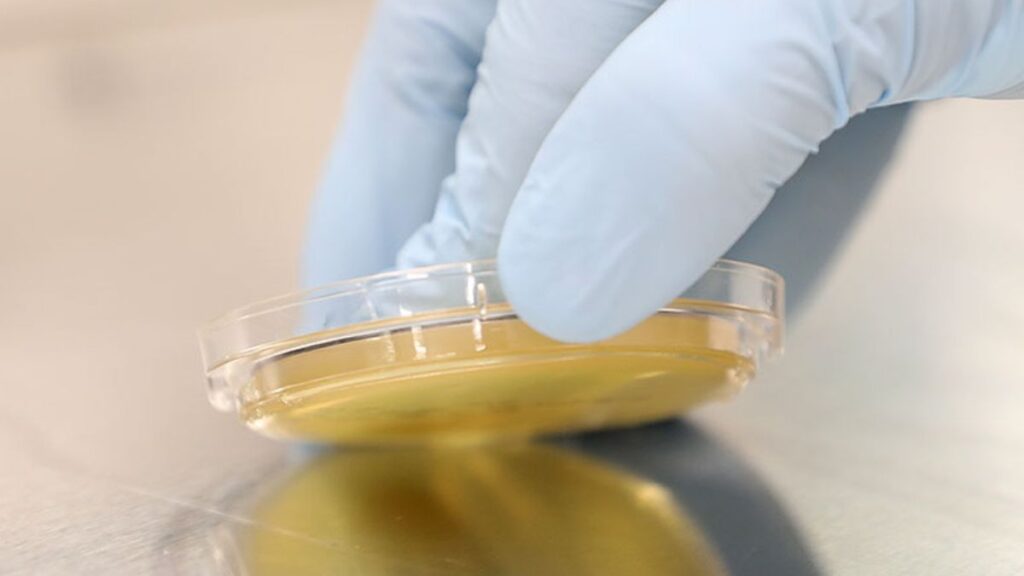 Contact plate / Rodac (Replicate Organism Detection and Counting) plate